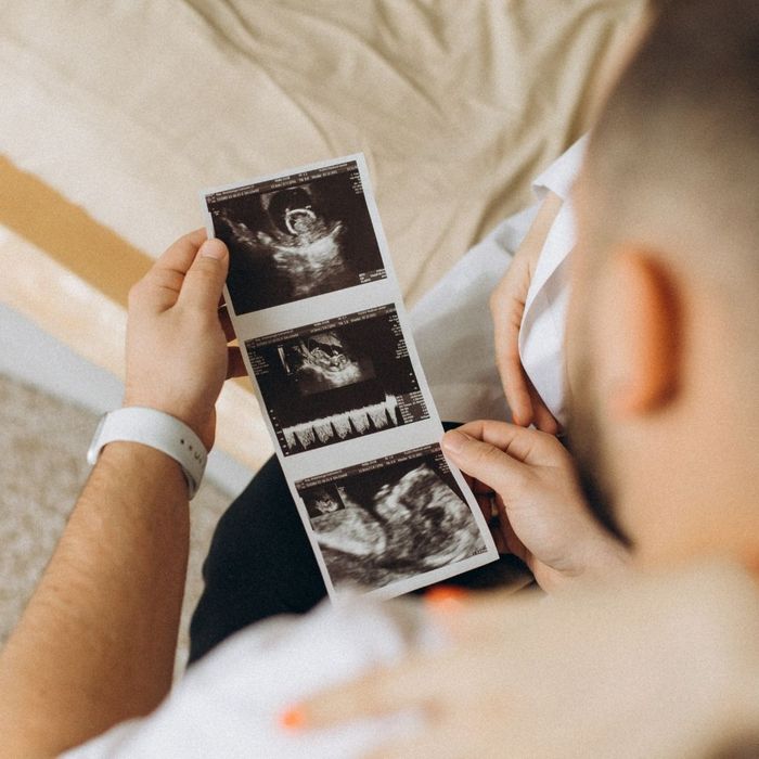 looking at ultrasound photos