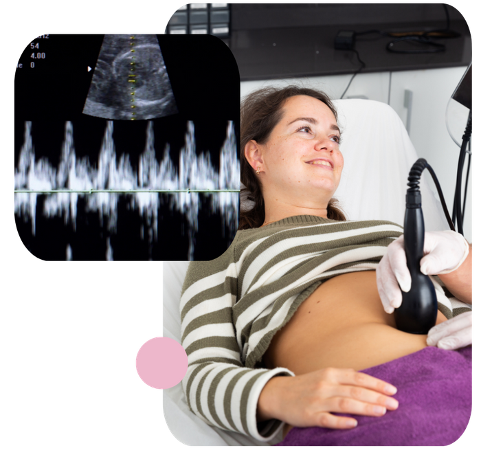 woman getting an ultrasound