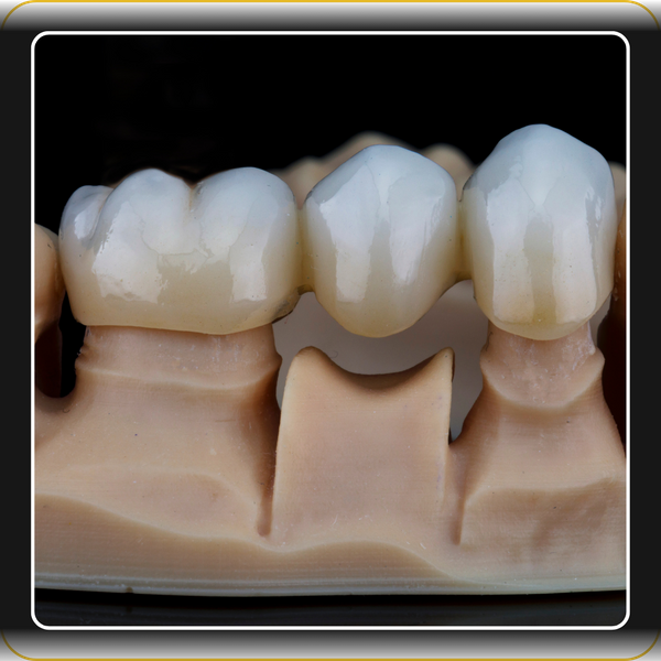 Dental Crown 1.png