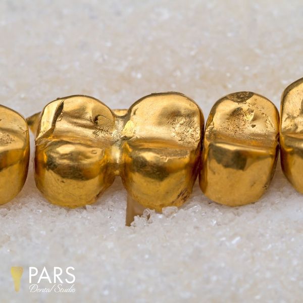 IMG 2 - Gold Crowns.jpg