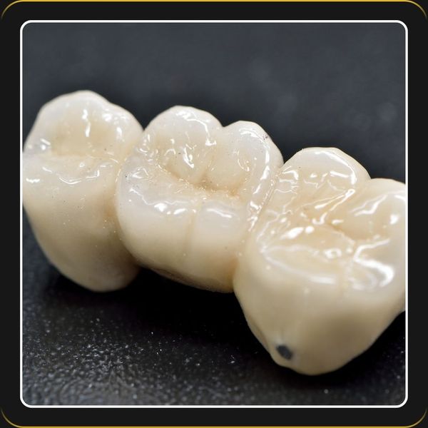 MultilayerAestheticZirconia-1.jpg