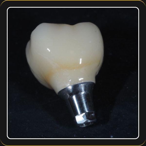 MultilayerAestheticZirconia-3.jpg