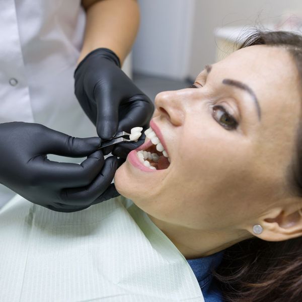 woman receiving veneers