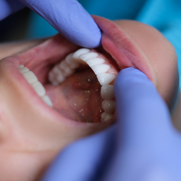 CosmeticDentistry-2.png