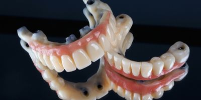 Two dental models of full upper and lower arches of teeth, showing the prosthetic gums and teeth with visible implant connections, set against a dark, reflective background.
