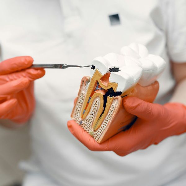 dentist pointing to tooth filling dentist pointing to tooth filling