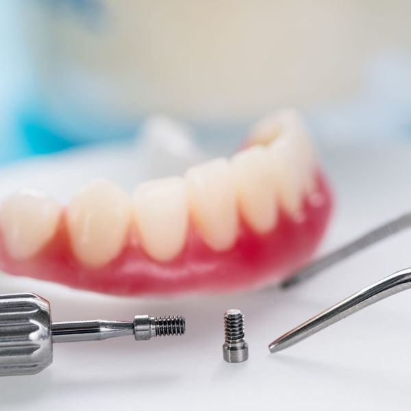 dental implants closeup