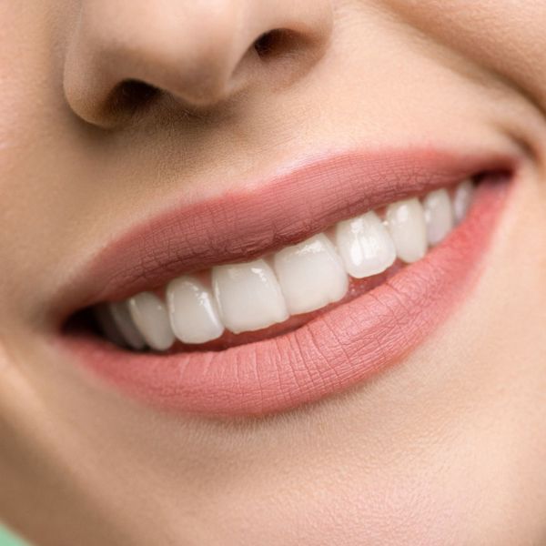 A close-up of a sparkling, perfectly white smile. A close-up of a sparkling, perfectly white smile.
