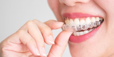 A close-up of a person smiling, holding a clear Invisalign aligner near their mouth, showing white teeth.