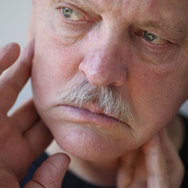 man with jaw pain man with jaw pain