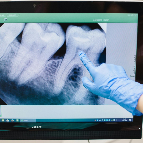 dentist looking at a tooth xray
