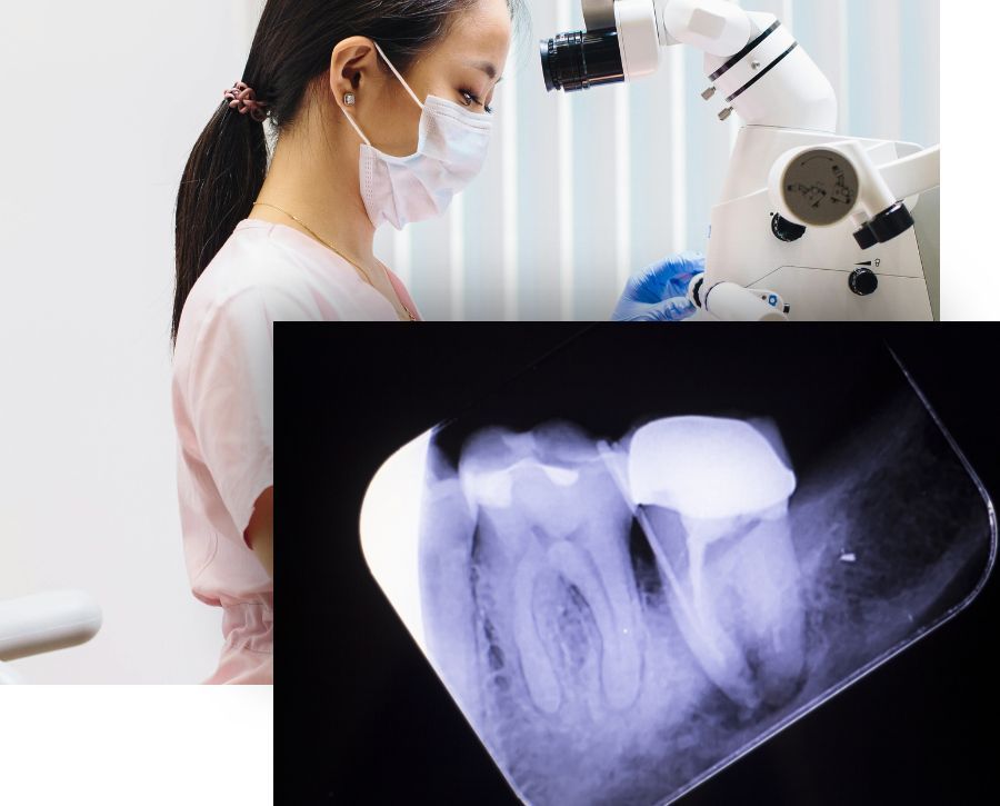 Root Canal Therapy - Image 1.jpg