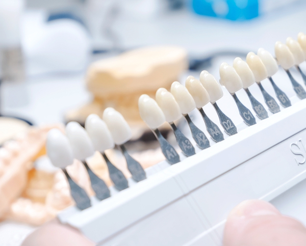 image of veneers