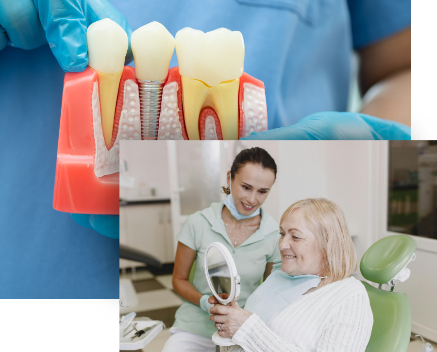 Root Canal Therapy - Image 1.png