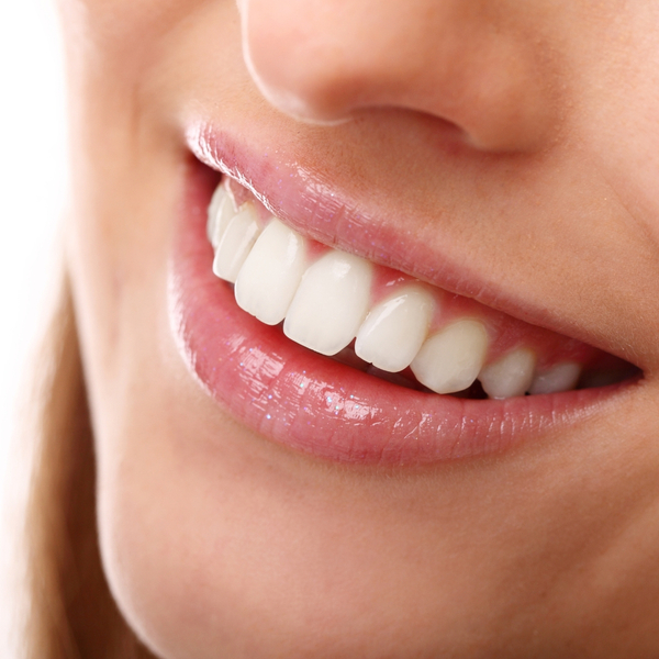 image of a smile