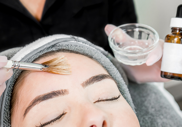 A woman getting a chemical peel