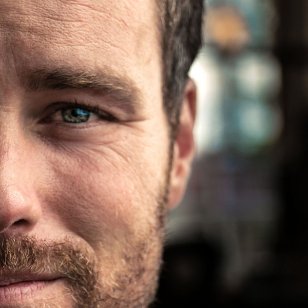 Crow's feet and eye wrinkles. Crow's feet and eye wrinkles.