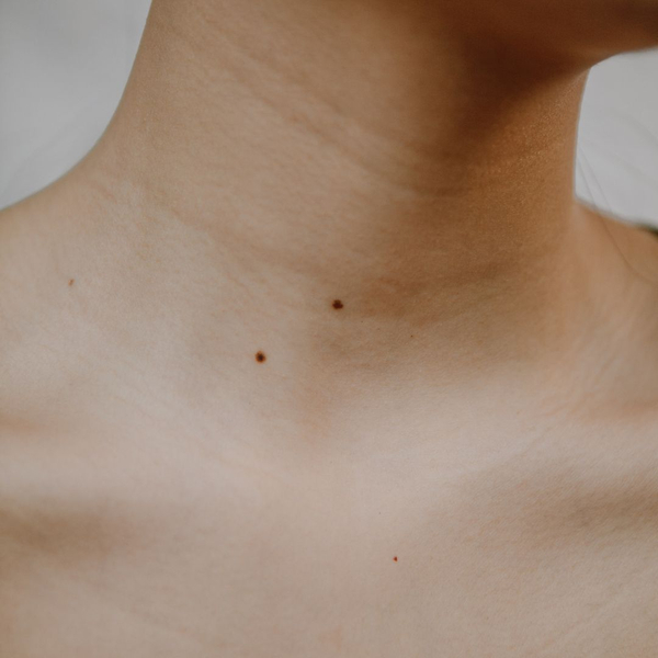Neck bands and wrinkles. Neck bands and wrinkles.