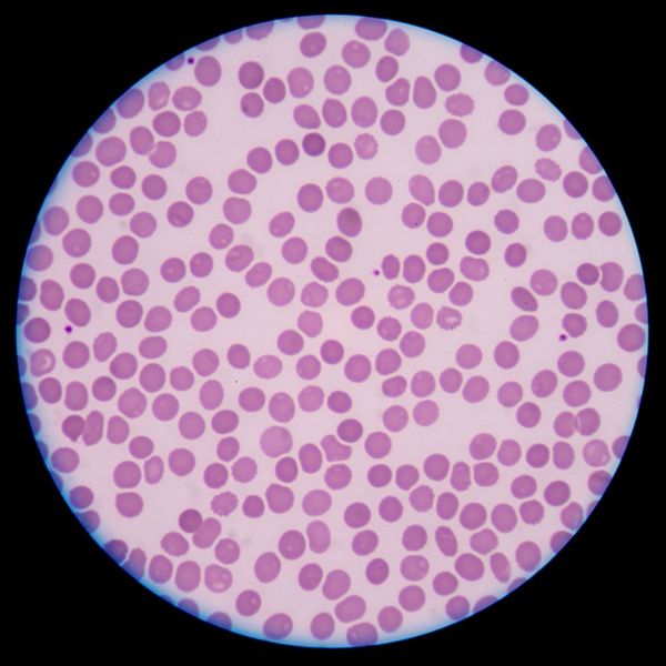 Microscopic view of platelets