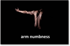 arm_numbness.png