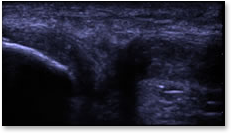 knee_ultrasound.png