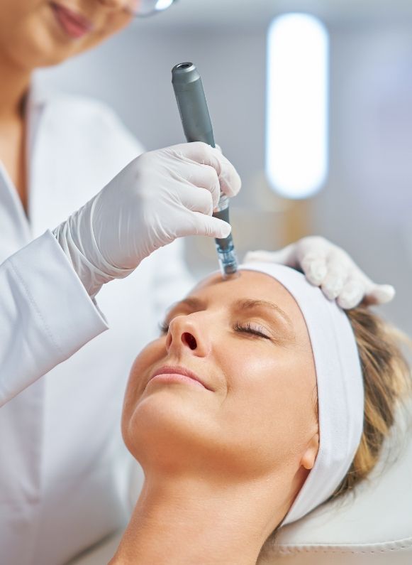 Microneedling