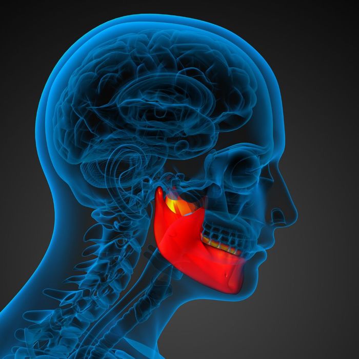 TMJ Disorder graphic