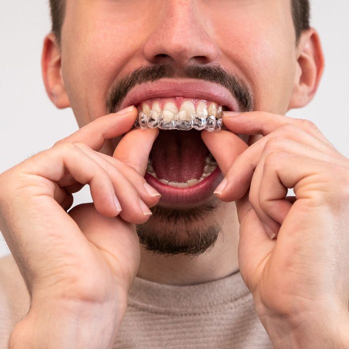 man inserting invisalign