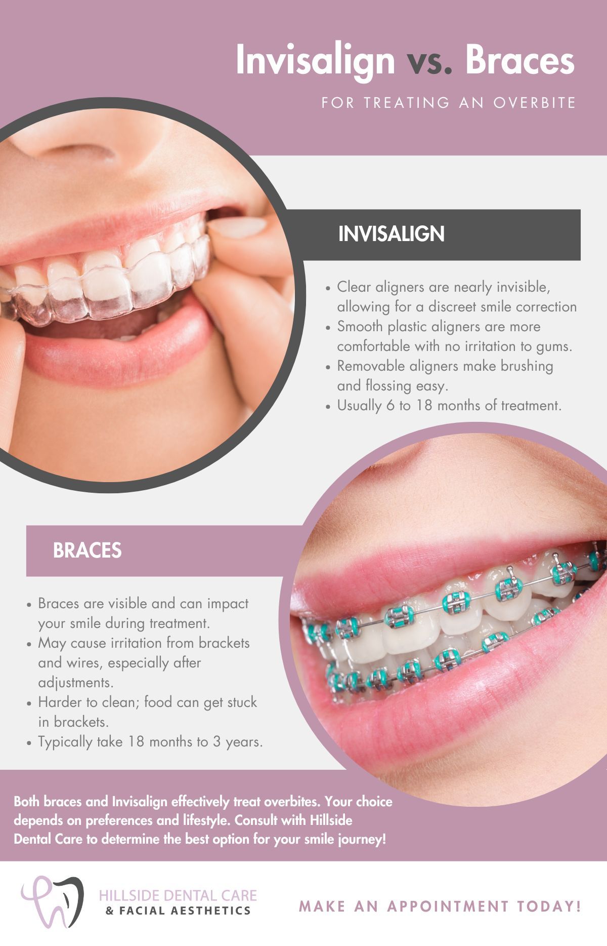 M44585 - IG - Invisalign vs. Braces.jpg