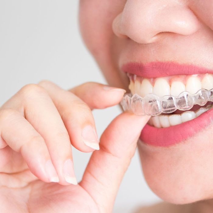 4 Invisalign Treatment for Teens_ The Convenient and Discreet Option.jpg