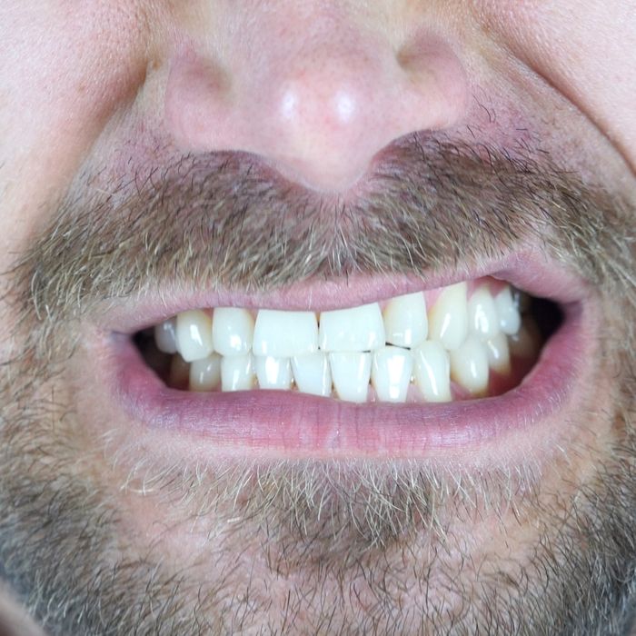 bearded man scowling his teeth