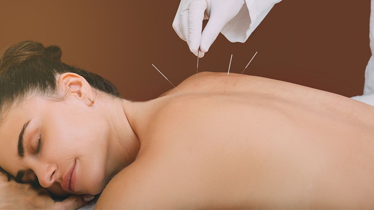acupuncture for wellness