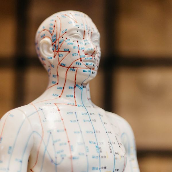 The Healing Power of Acupuncture for Sports Injuries-image1.jpg