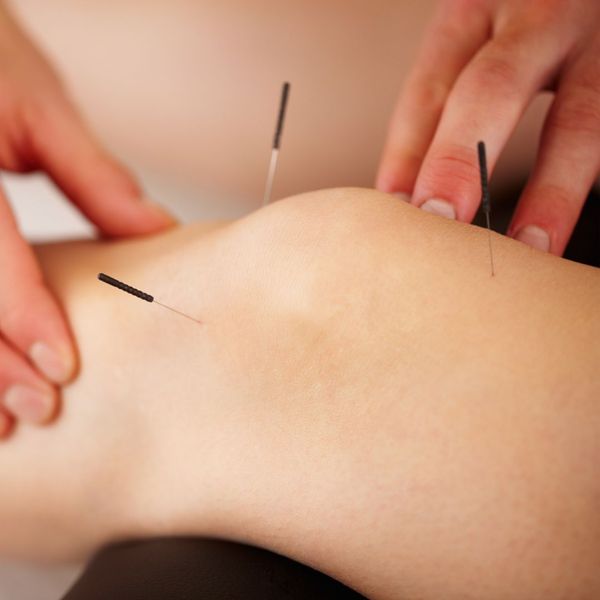 The Healing Power of Acupuncture for Sports Injuries-image2.jpg