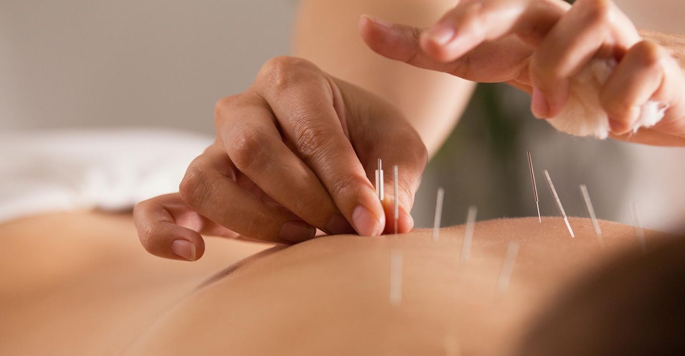 What Are The Four Benefits of Acupuncture BB Featured Image.jpg