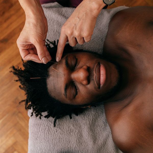 Man getting acupuncture