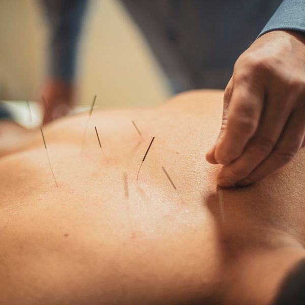 The Healing Power of Acupuncture for Sports Injuries-image3.jpg