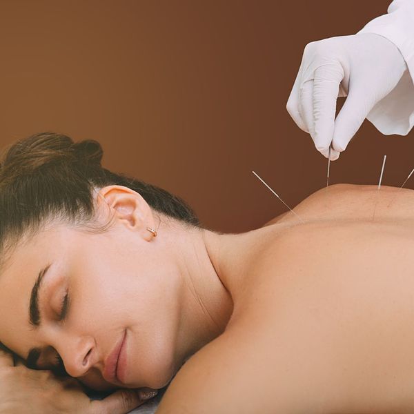 The Healing Power of Acupuncture for Sports Injuries-image5.jpg