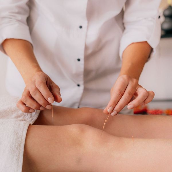 acupuncture in knee and leg
