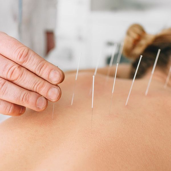 Why Should Naperville Residents Choose Acupuncture for Pain Management?