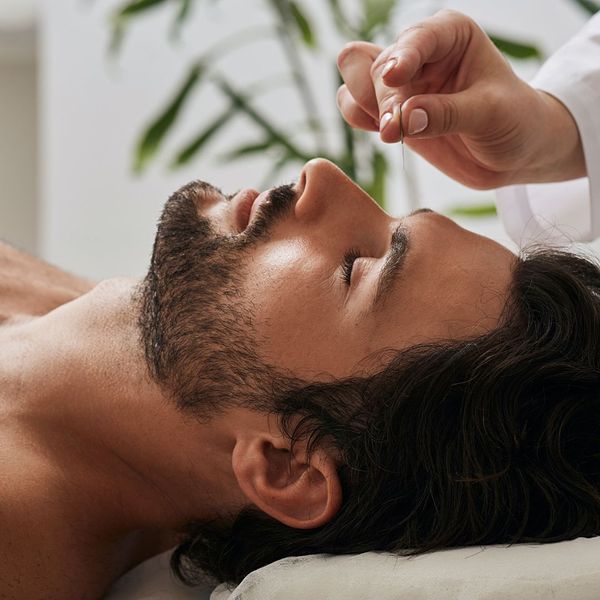 man undergoing acupuncture treatment