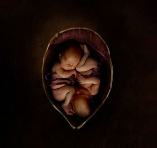 Godwin Twins Womb 2.jpg