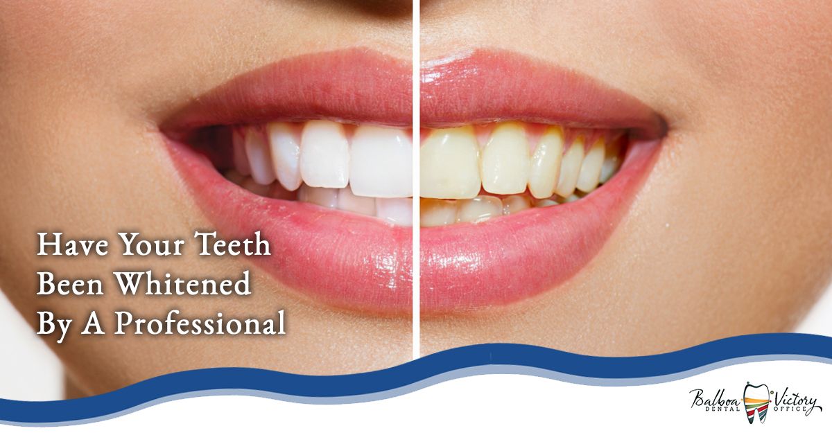 Have-Your-Teeth-Whitened-By-A-Professional-59de8581a46bf.jpg