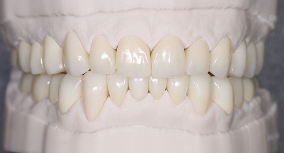 teeth