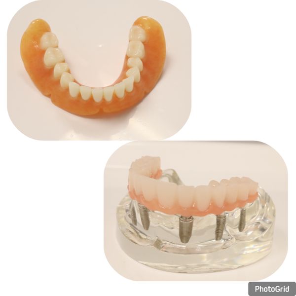 Complete dentures.jpg