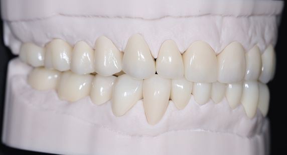 teeth