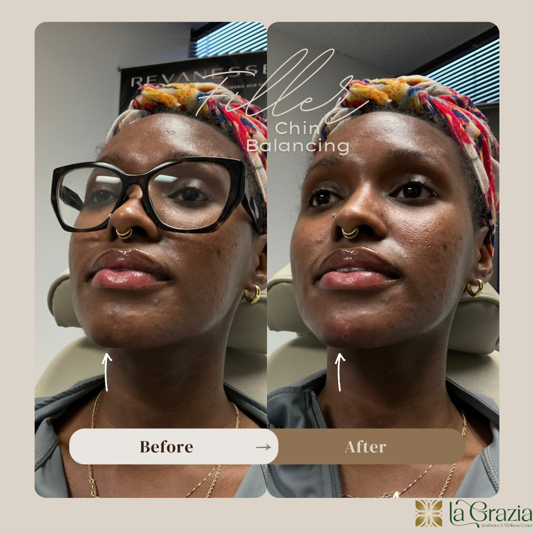 Beige Minimalist Before After Hair Salon Instagram Post - 2.png
