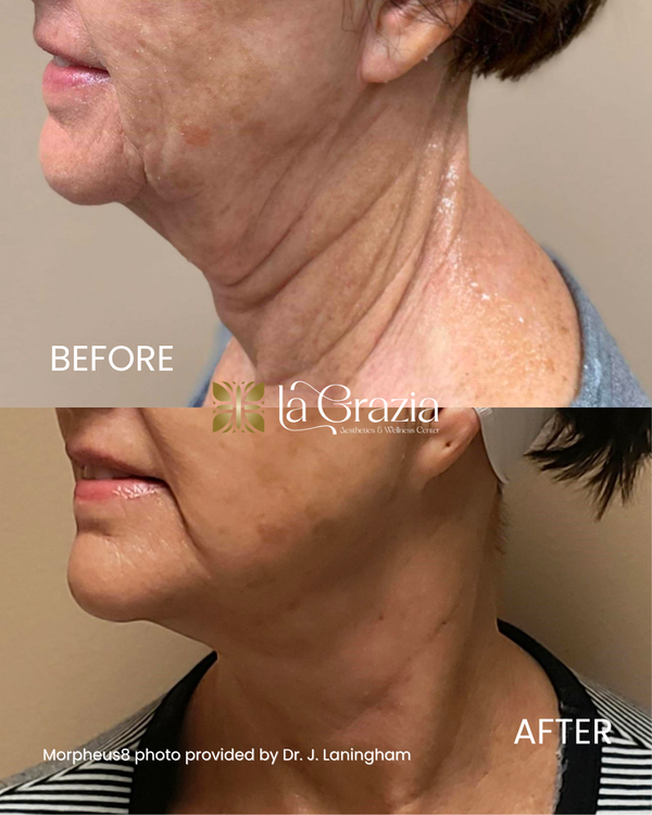 Before & After (1).png