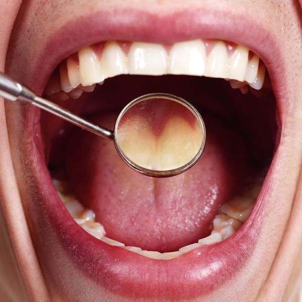 Dental oral screenings