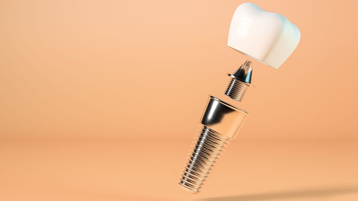 dental implant header.jpg